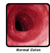 Normal Colon